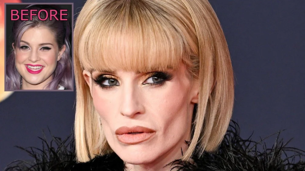 Kelly Osbourne Ozempic and Plastic Surgery Speculation