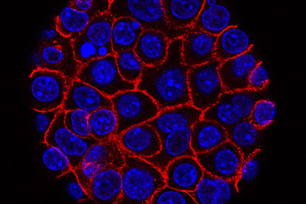 GSK Secures Global Rights to Hutchmeds Novel KRAS-EGFR Antibody-Targeted Therapy Conjugate in 1.4 Billion Dollar Deal